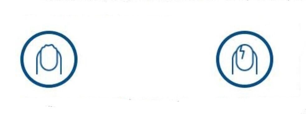 küünte deformatsioon seeninfektsiooni tõttu